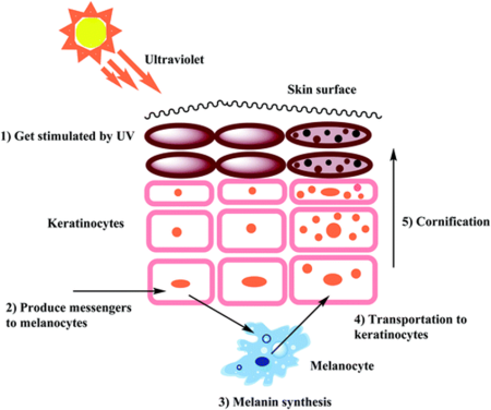 Melasma