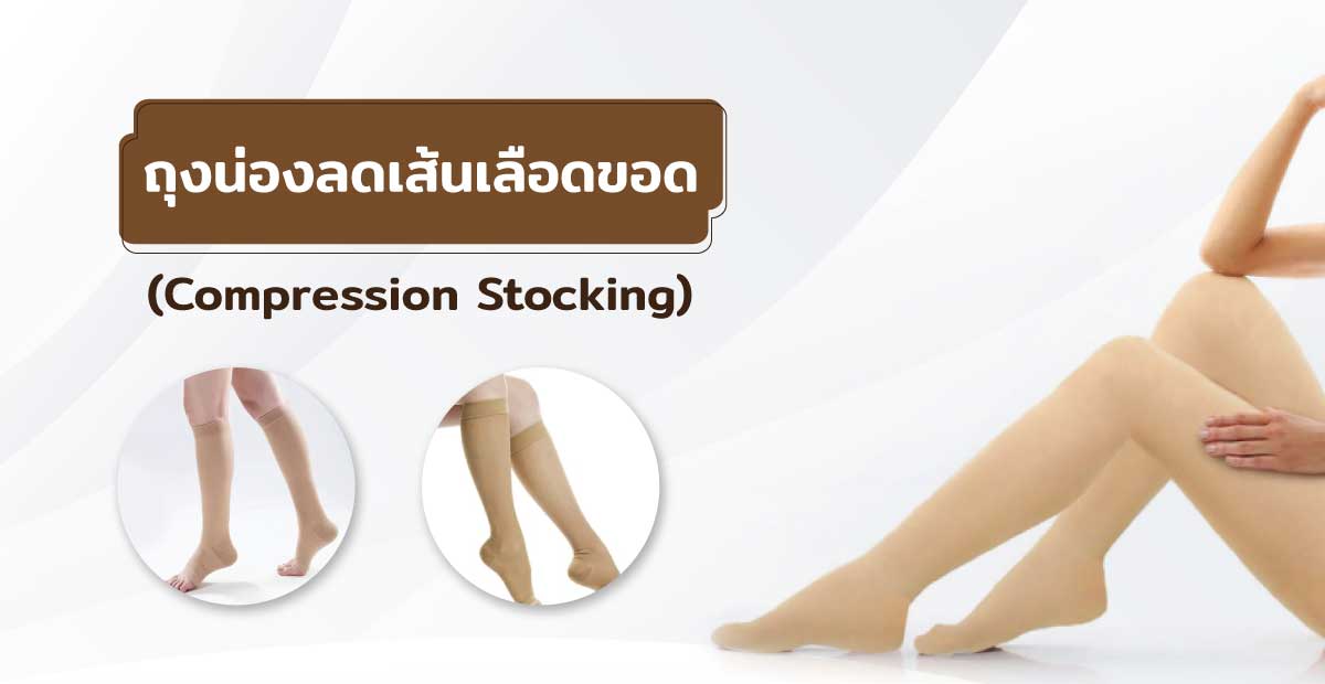 ถุงน่องลดเส้นเลือดขอด (Compression Stocking)